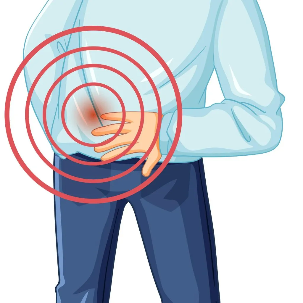 Laser Pilonidal Surgery - cosmocurehealth