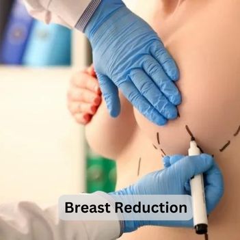 Breast Reduction