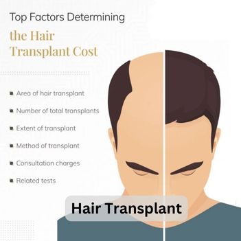 Hair Transplant