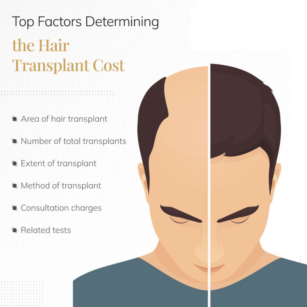 Hair transplant at cosmocure